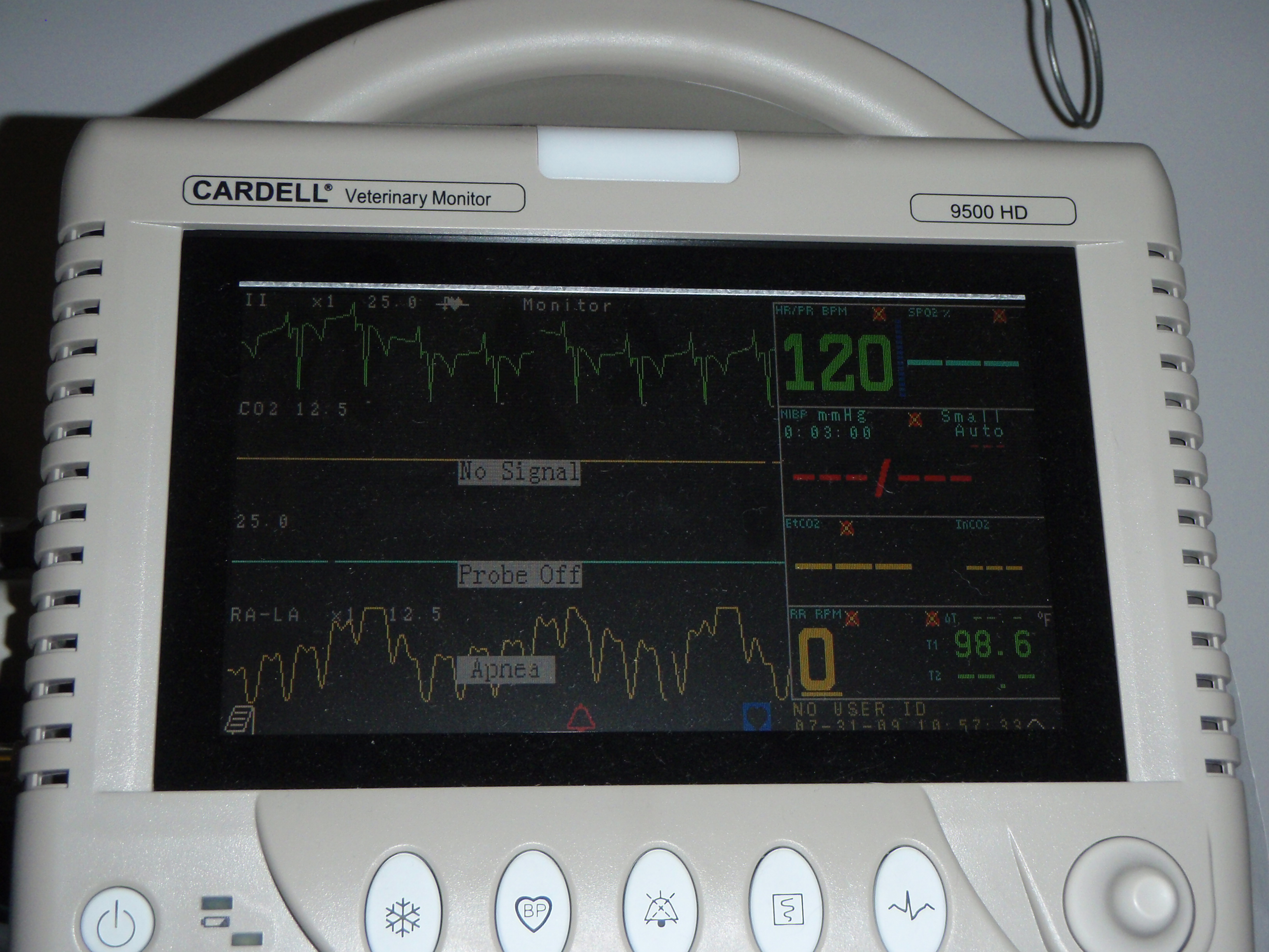 anesthetic monitor